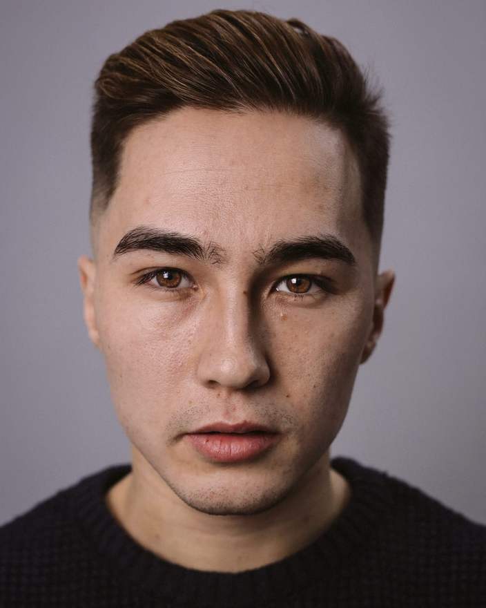 Skin retouching — before